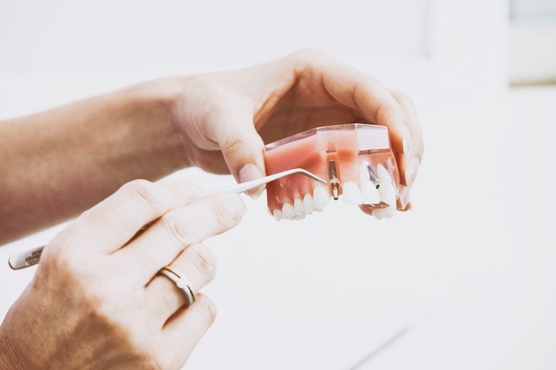 120歳まで健康に生きるための… 歯のメンテナンス